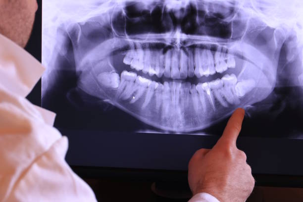 Best Broken or Chipped Tooth Repair in Broad Brook, CT